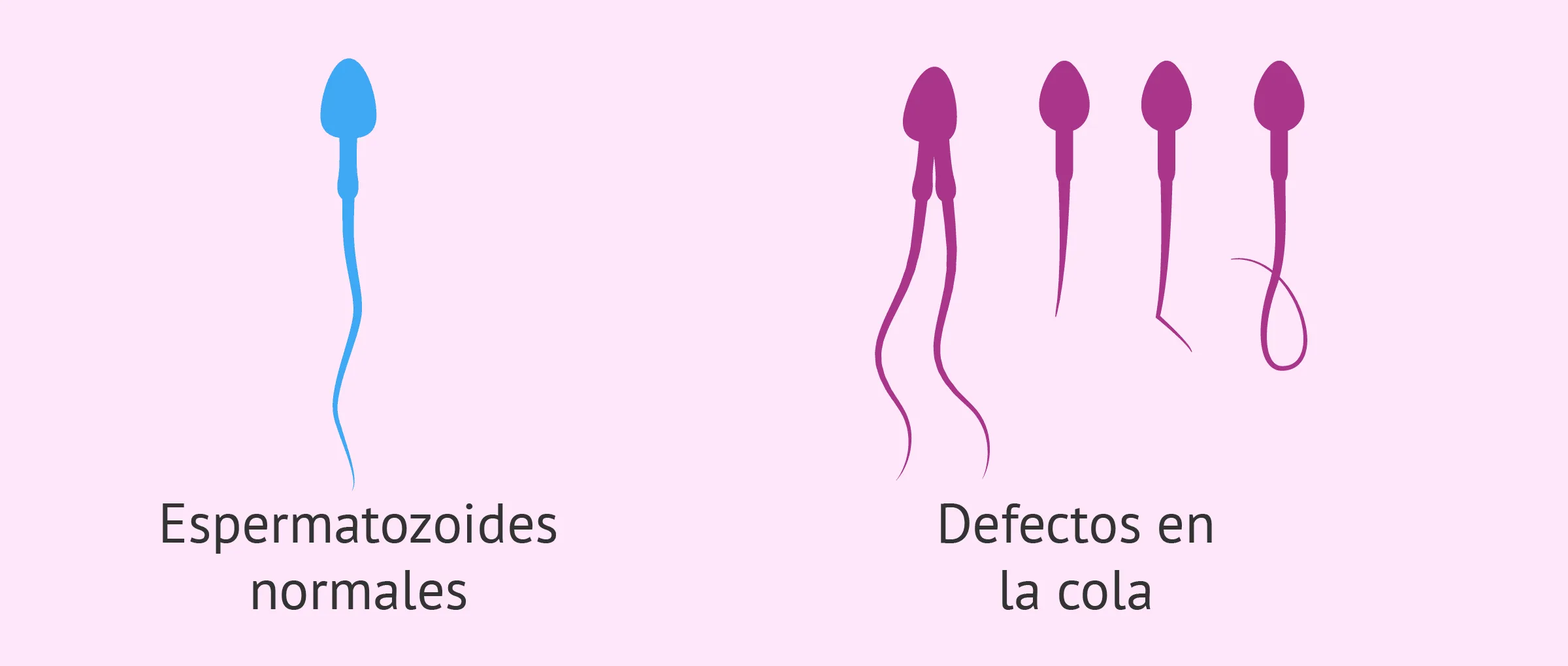 Defectos en la cola de los espermatozoides