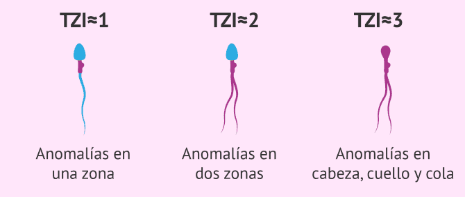 Imagen: Índice de teratozoospermia