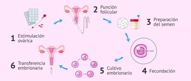 Imagen: Tipos de FIV