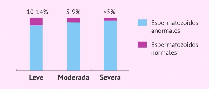 Imagen: Tipos de teratozoospermia