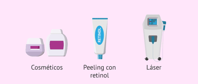 Imagen: Tratamiento para eliminar las estrías