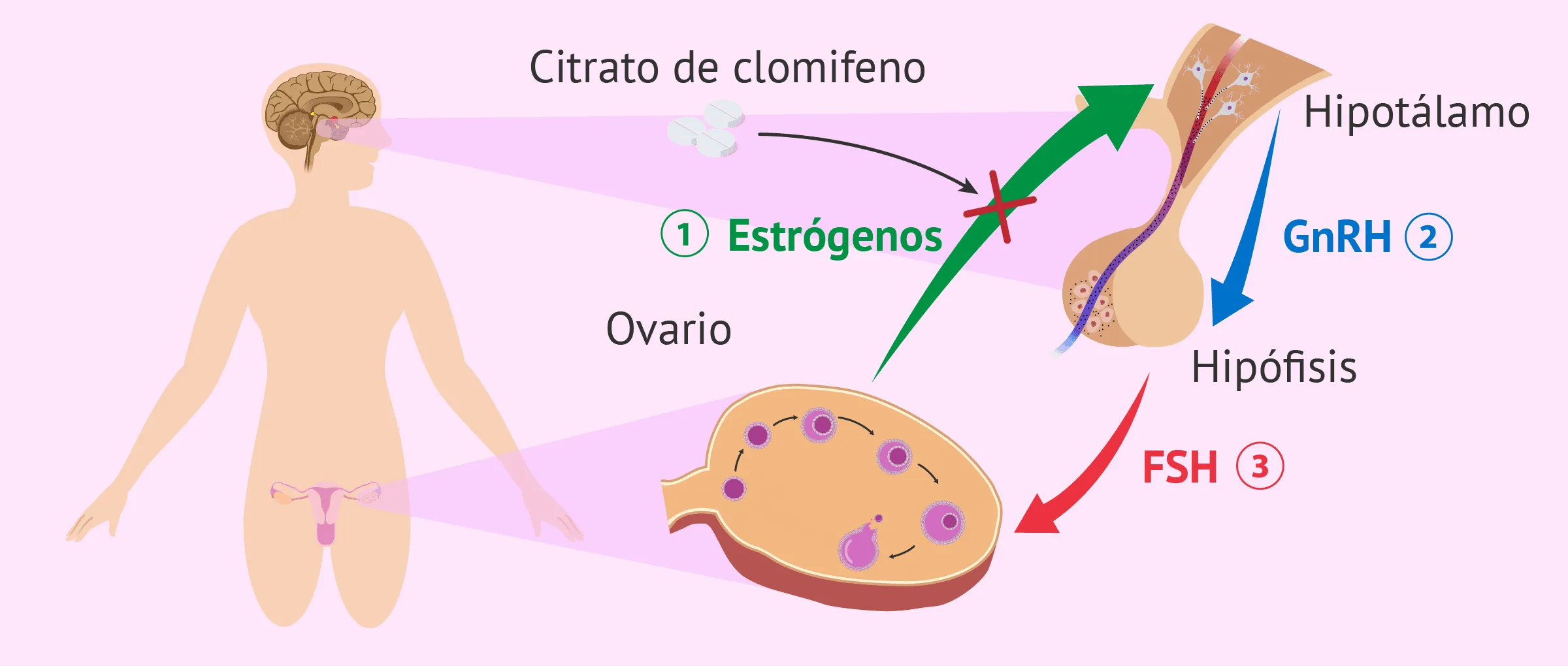 Citrato de clomifeno para inducir la ovulación