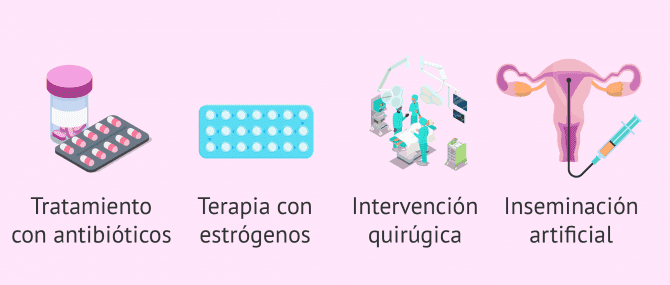 Imagen: Tratamiento del factor cervical