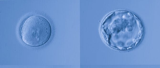 Imagen: Óvulos fecundados y preembriones