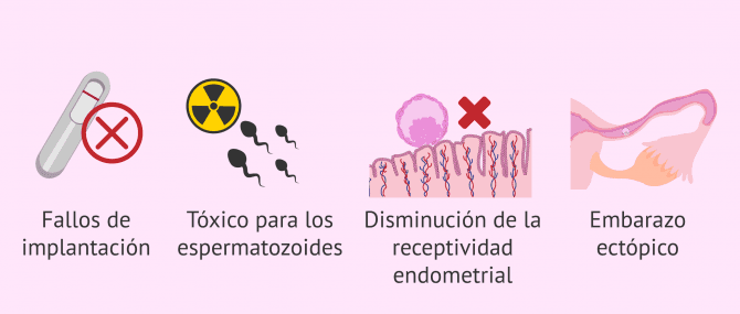 Imagen: Efectos del hidrosalpinx para la fertilidad