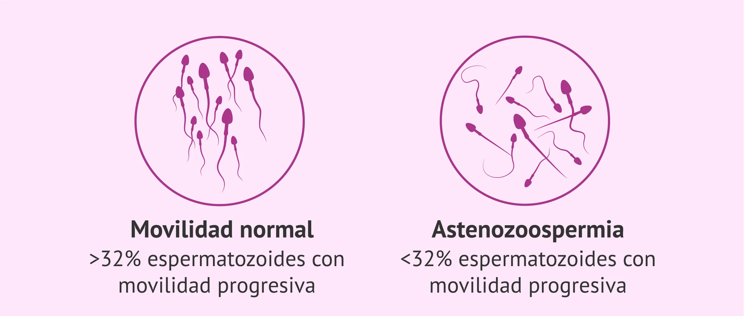 Imagen: Astenozoospermia.