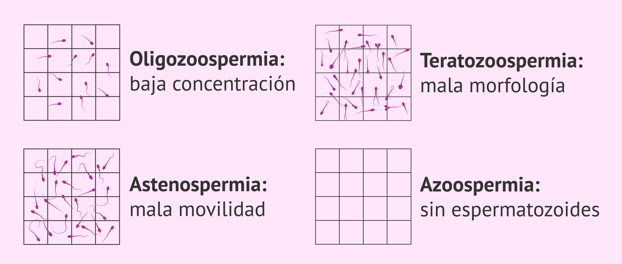 Imagen: Alteraciones en la calidad seminal