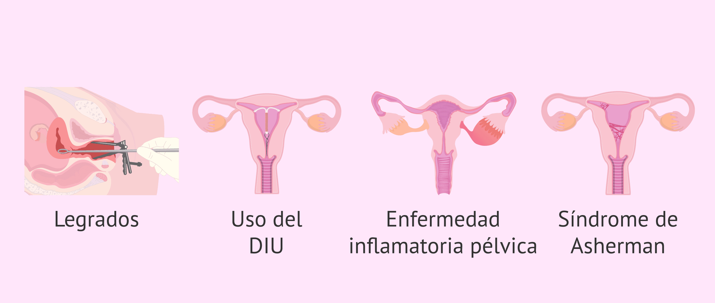 ¿Qué es la hipomenorrea?