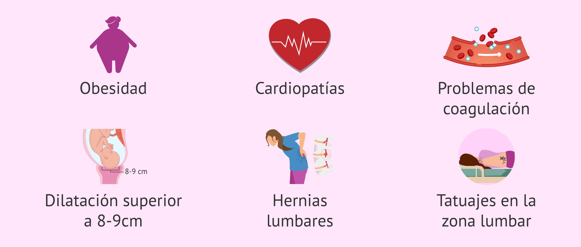 Imagen: ¿Cuándo no se aconseja la epidural?