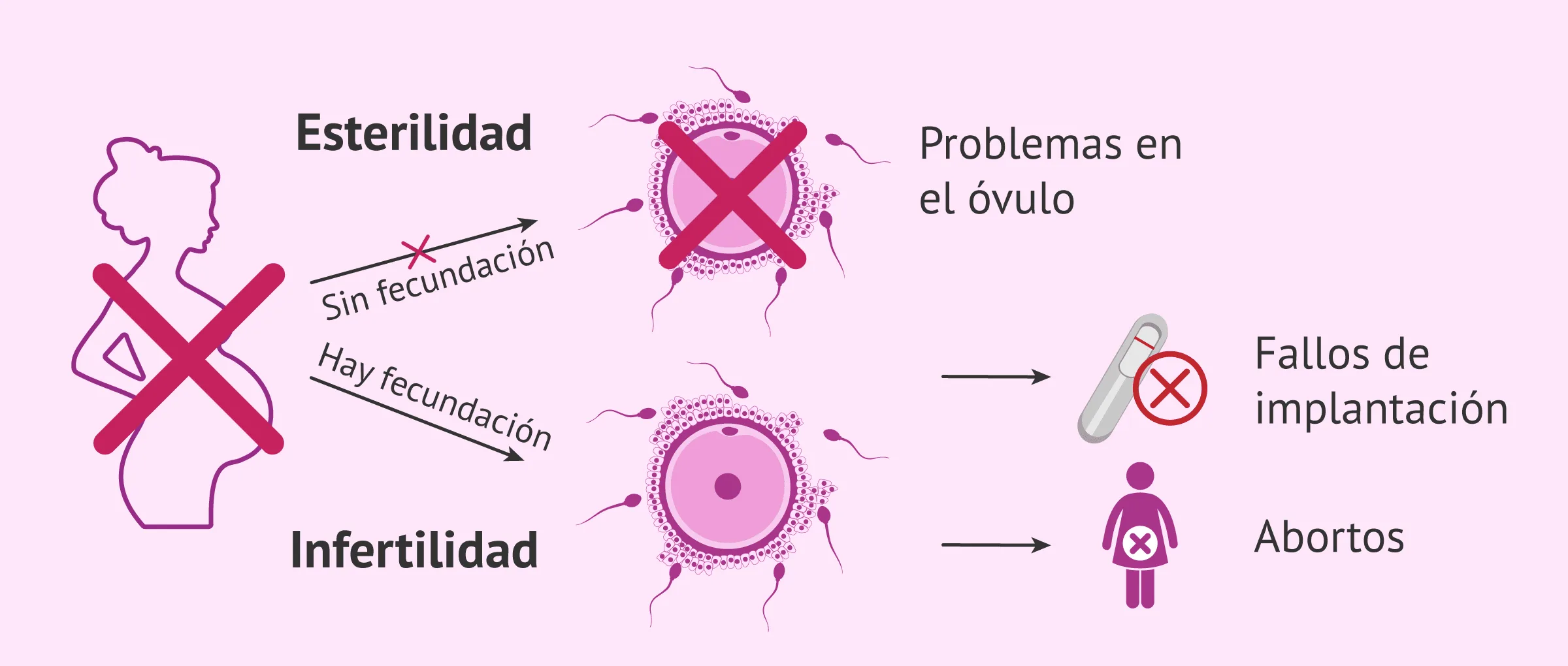 ¿Qué causa la esterilidad femenina? – Síntomas y tratamientos