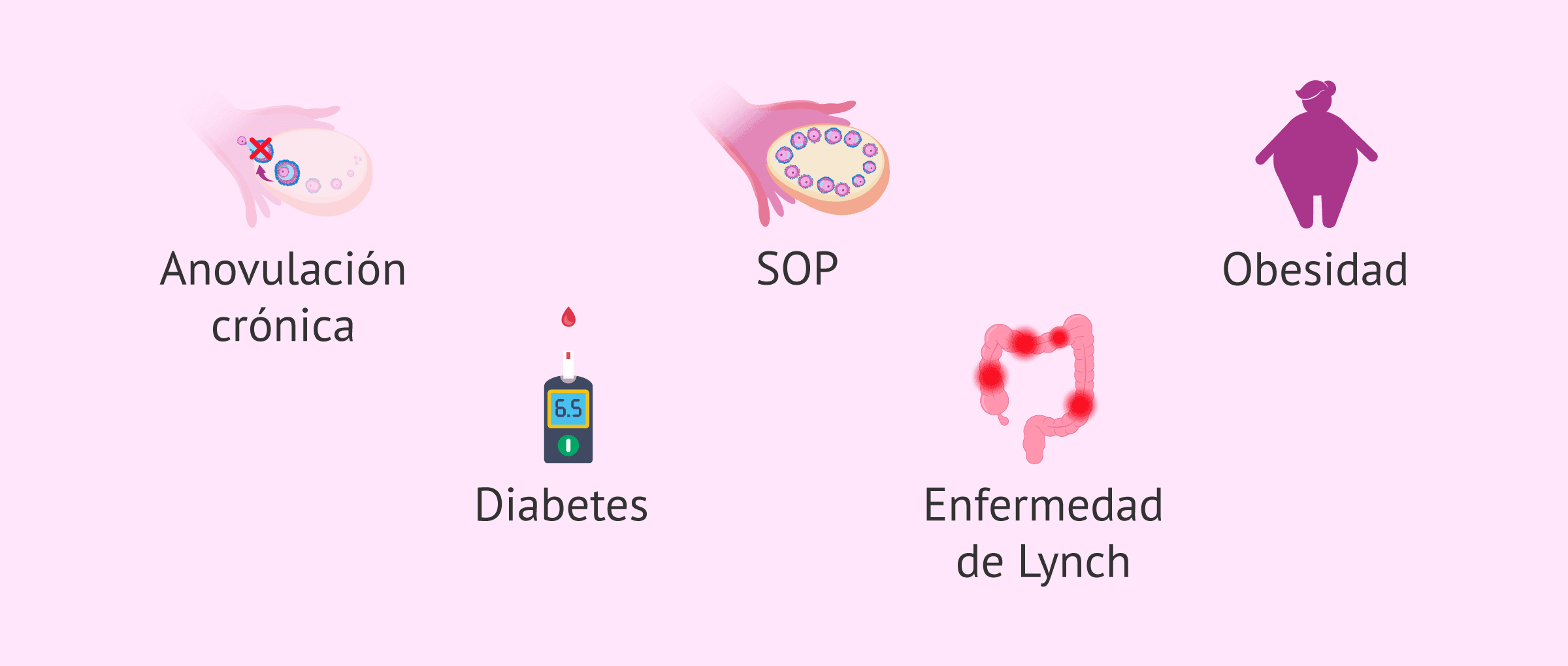 Imagen: Factores de riesgo de la hiperplasia endometrial