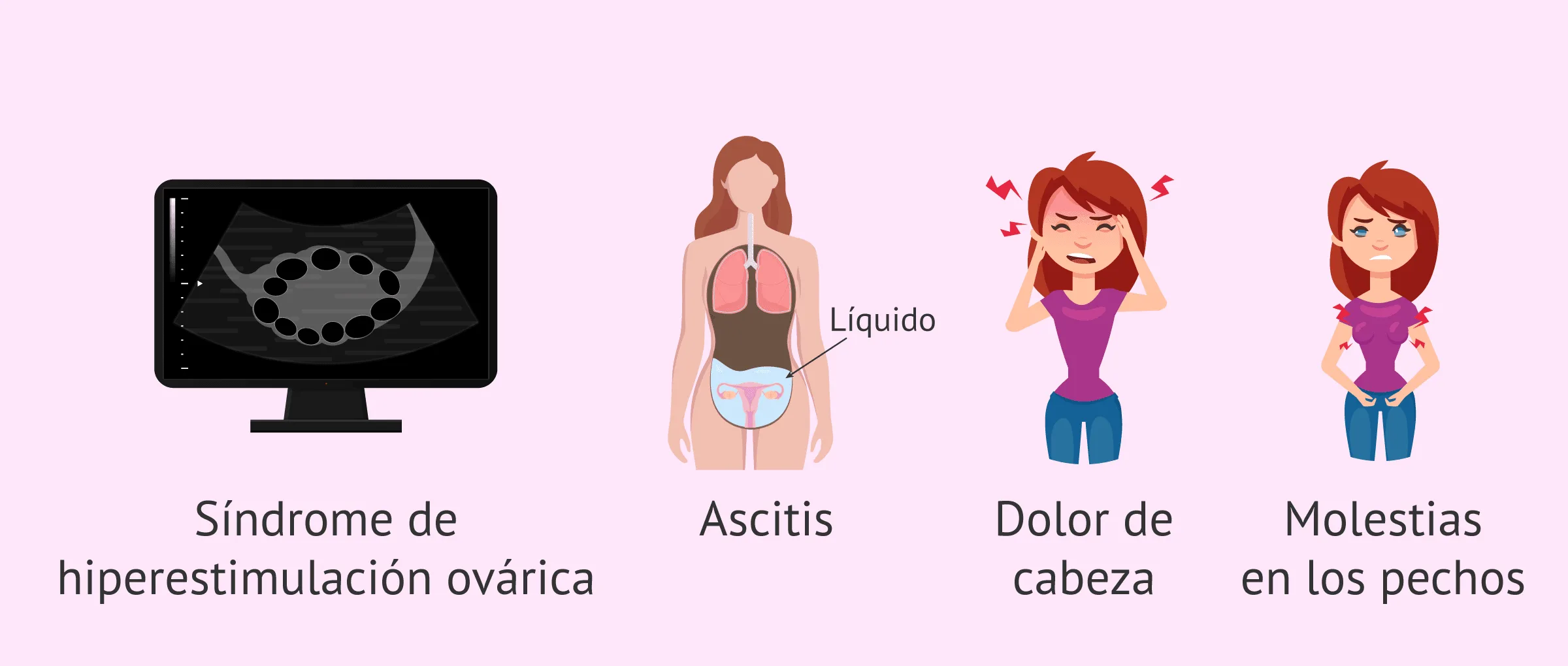 Imagen: Consecuencias de la estimulación ovárica en la IA