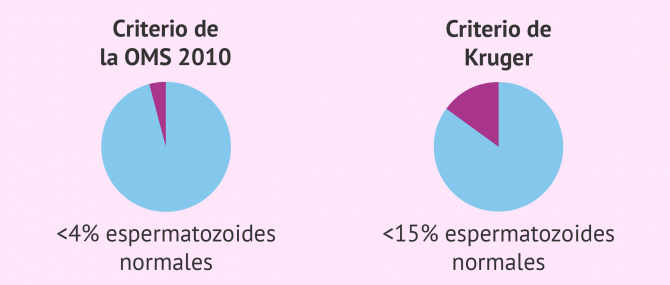 Imagen: Diagnóstico de la teratozoospermia en el seminograma