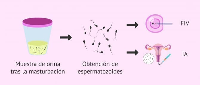 Imagen: Tener un hijo con eyaculación retrógrada