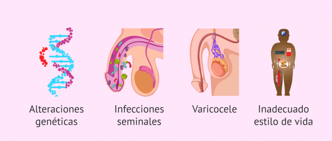 Imagen: ¿Qué factores provocan teratozoospermia?