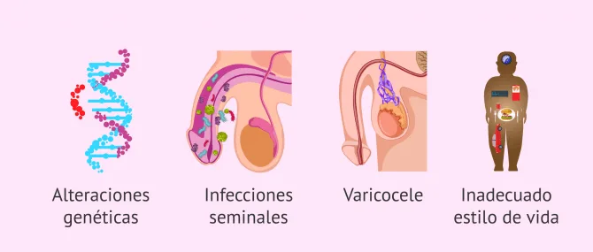 Imagen: ¿Qué factores provocan teratozoospermia?