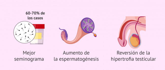 Imagen: Mejoras después de la cirugía de varicocele