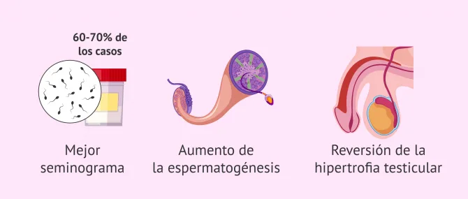 Imagen: Mejoras después de la cirugía de varicocele