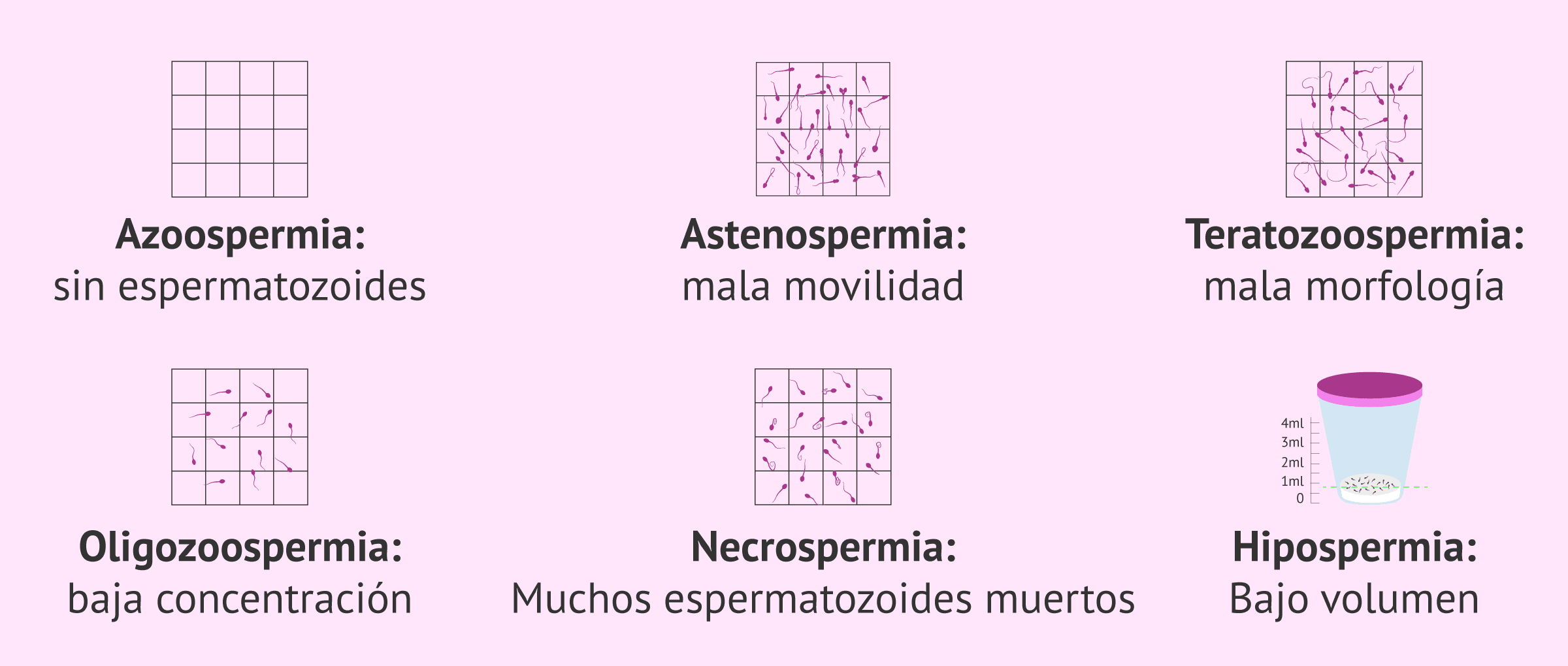 Resultados del seminograma