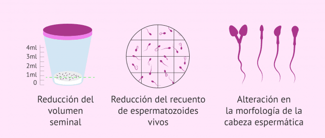 Imagen: Efectos del colesterol elevado en la fertilidad masculina