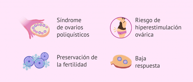 Imagen: Indicaciones de la maduración in vitro (IVM)