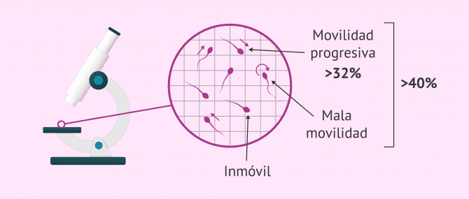 Imagen: Valores normales de movilidad espermática