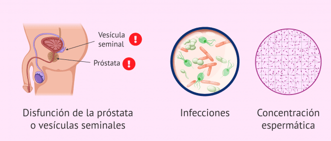 Imagen: Causas de variación en la consistencia del esperma