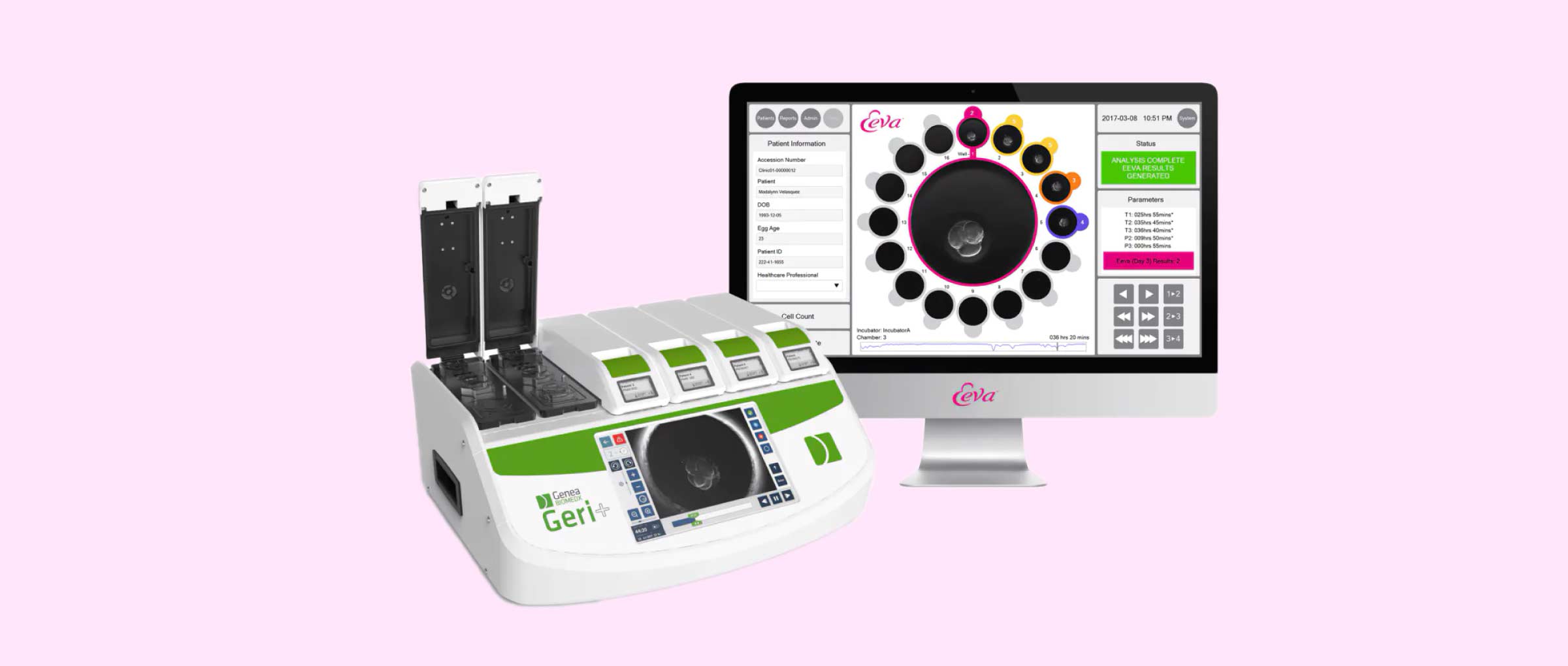 Test Eeva: un método para optimizar la selección embrionaria