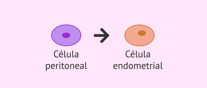 Imagen: Metaplasia celómica