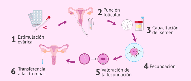 Imagen: Transferencia embrionaria en las trompas de Falopio.