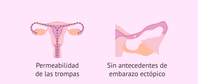 Imagen: Requerimientos para una ZIFT