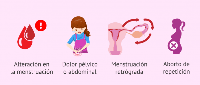 Imagen: Síntomas del síndrome de Asherman