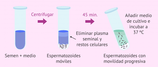 Imagen: swim-up-espermatozoides