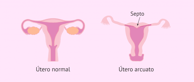 Imagen: utero-arcuato-glosario