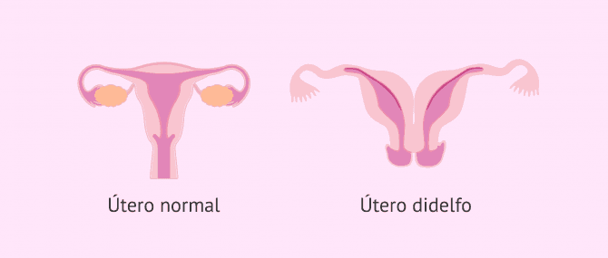 Imagen: utero-didelfo-glosario