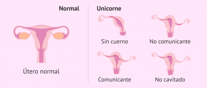 Imagen: utero-unicorne-glosario