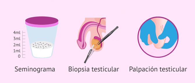 Imagen: Pruebas diagnósticas para la azoospermia obstructiva