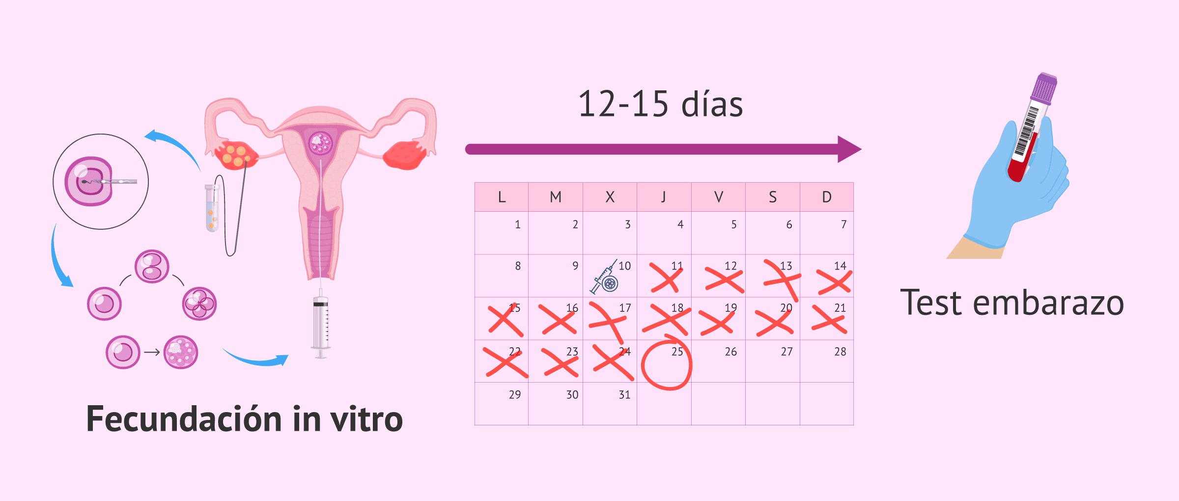 Imagen: Periodo de betaespera después de una FIV