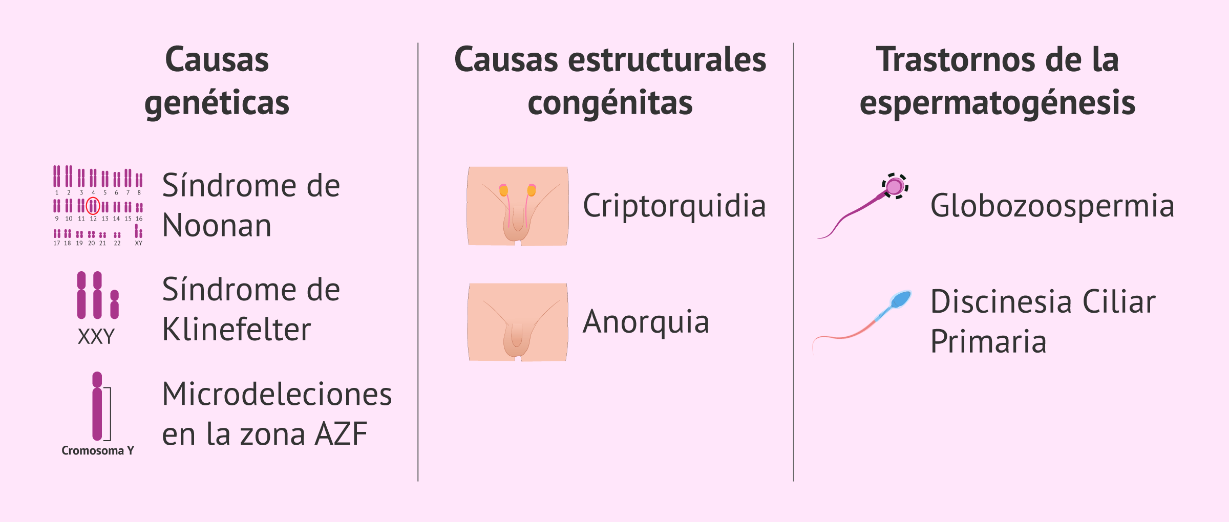 Imagen: Infertilidad masculina por factor testicular congénito