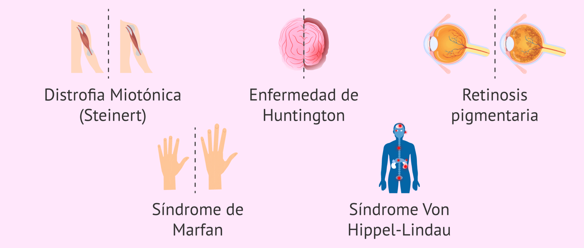 Listado de algunas enfermedades de herencia autosómica dominante