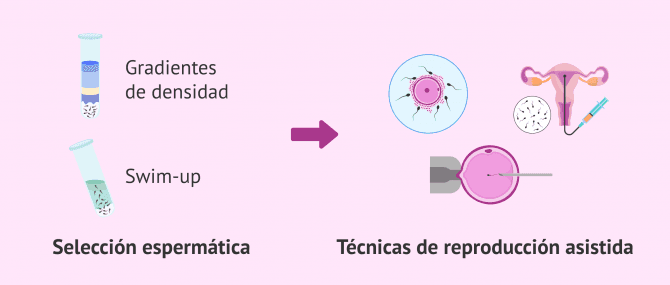 Imagen: Métodos tradicionales de selección espermática