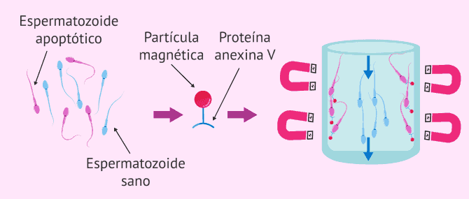 Imagen: Selección de espermatozoides mediante MACS