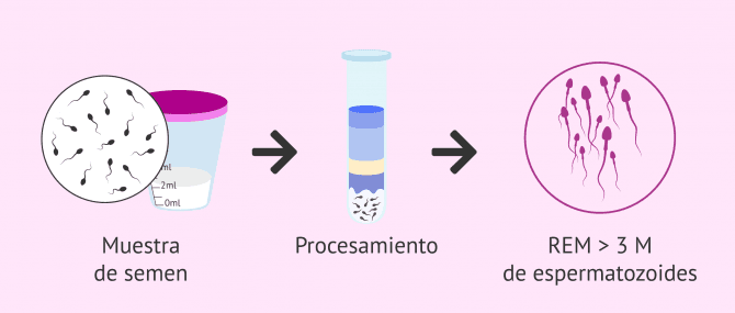 Imagen: Calidad seminal para una IA