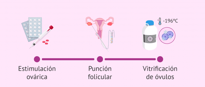 Imagen: ¿Cómo es el proceso de vitrificación de óvulos?