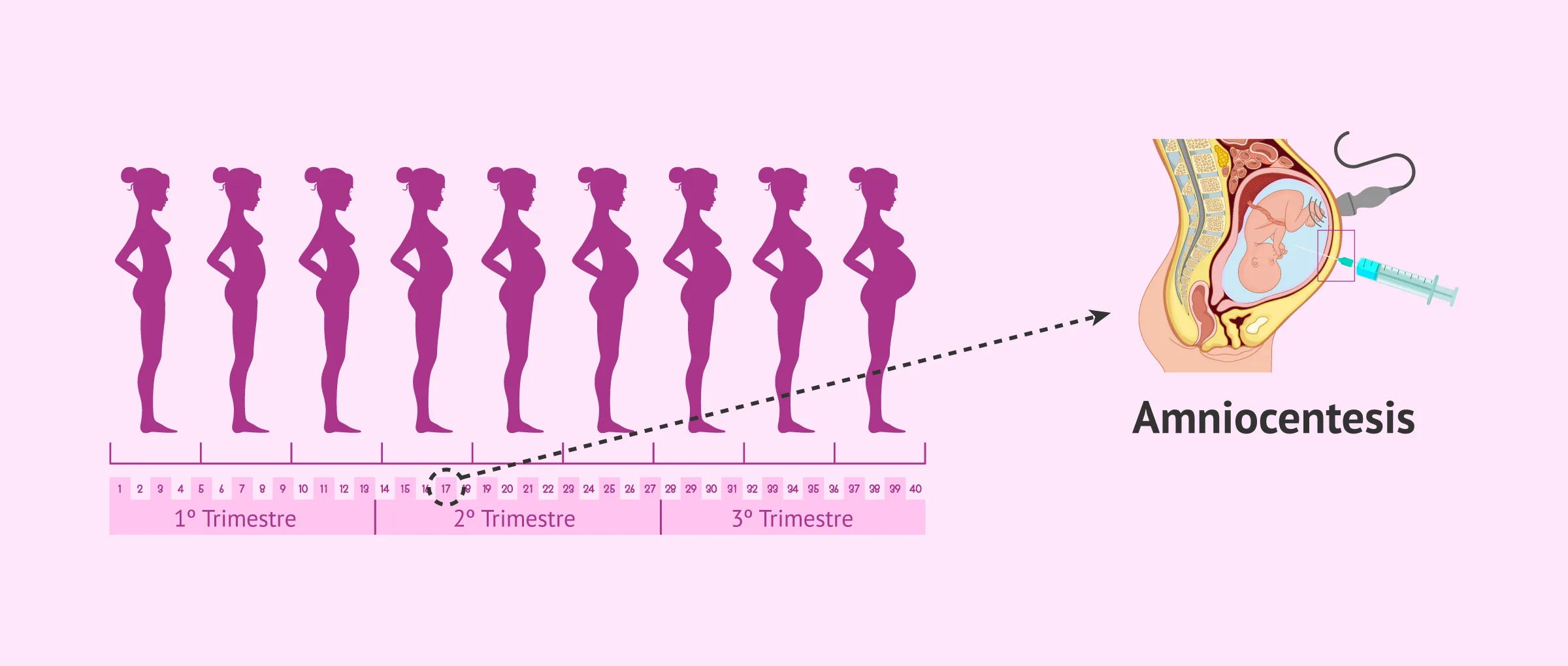 Pruebas médicas en la semana 17 de embarazo