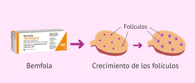 Imagen: accion-medicamento-bemfola