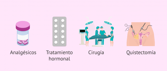 Imagen: Tratamiento de la endometriosis y embarazo natural