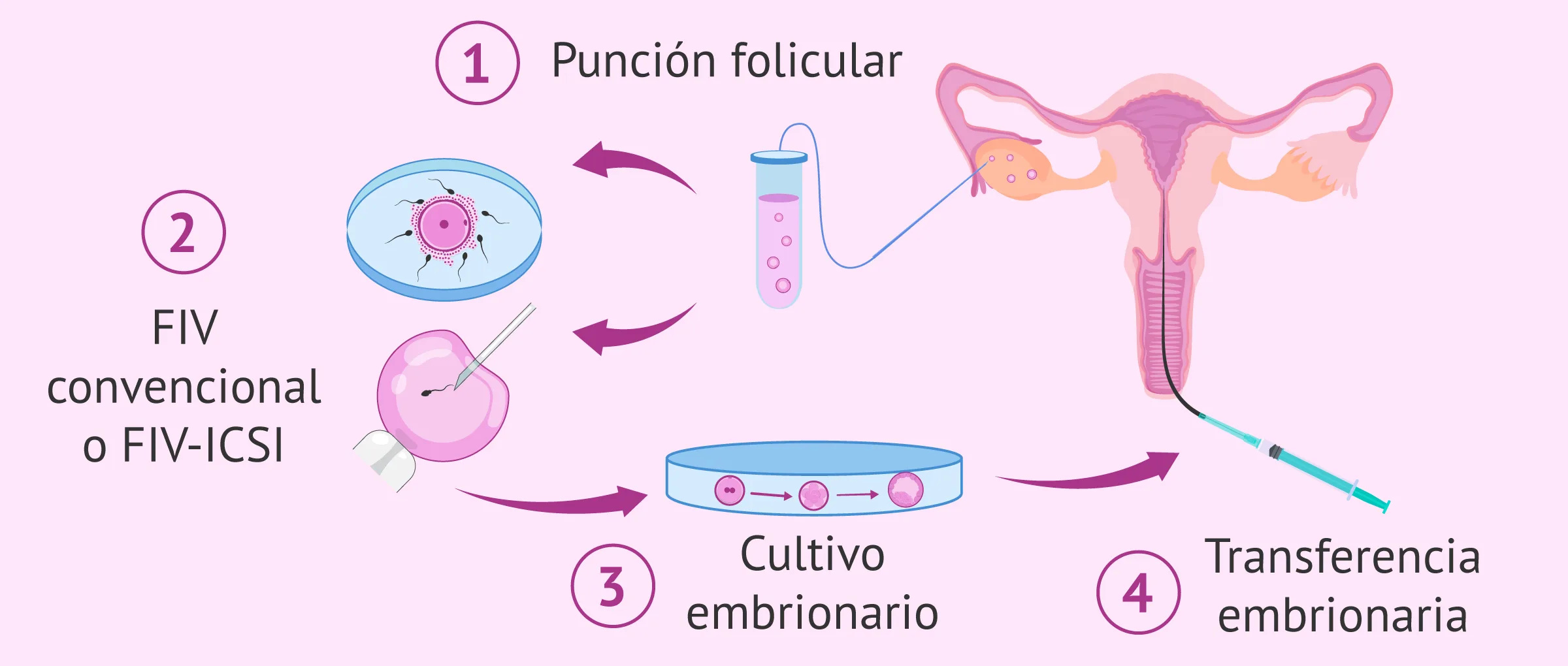 El proceso de FIV