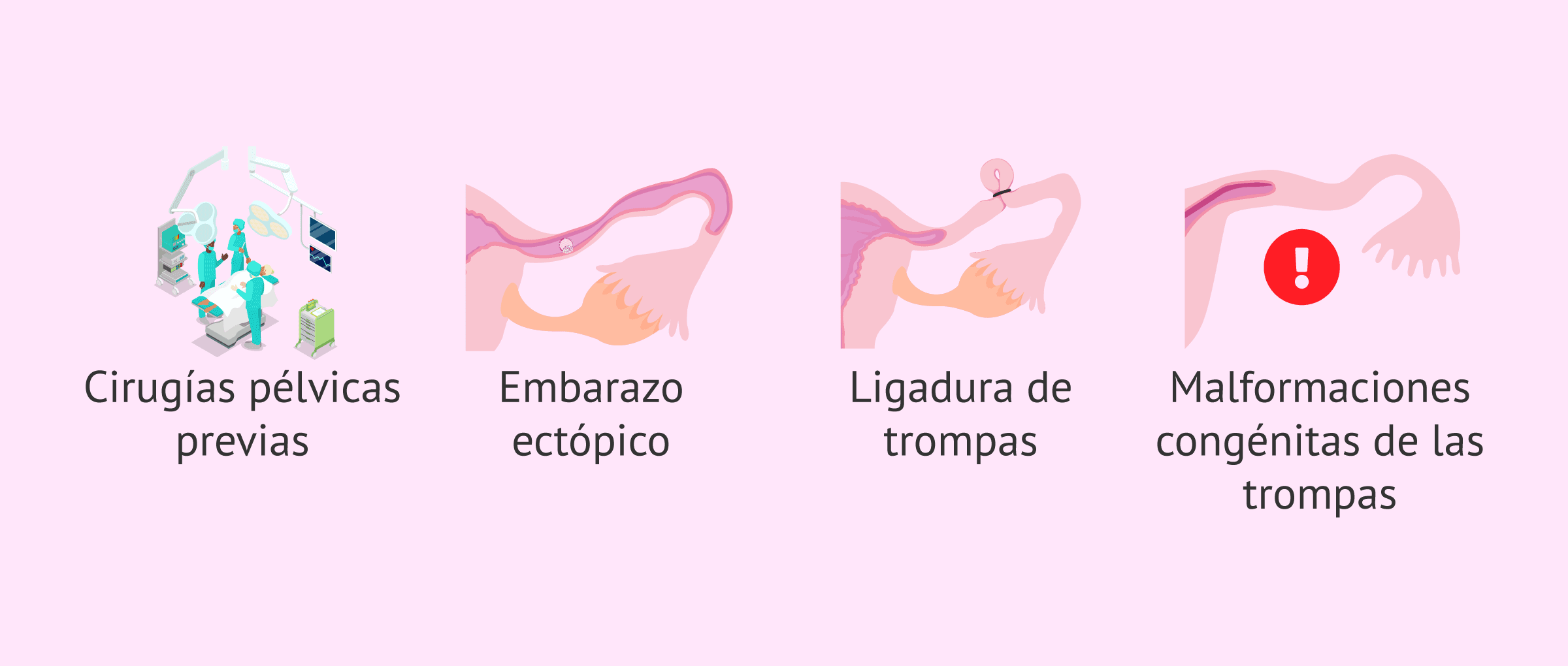 Imagen: Otras causas de factor tubárico