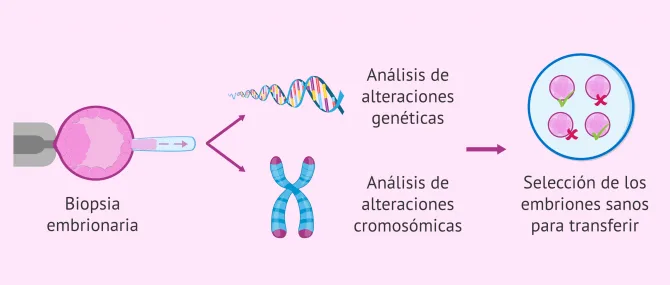 Imagen: Procedimiento del PGT